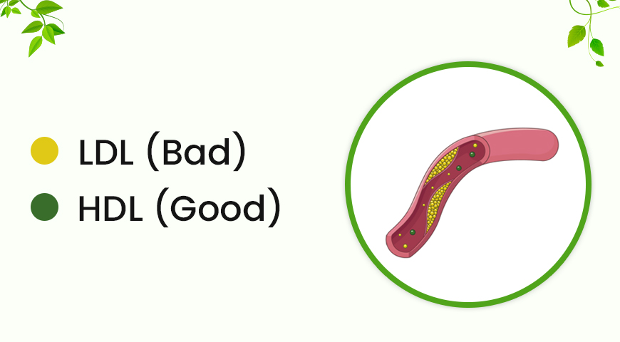 gall bladder stone can be caused by Too much cholesterol in your bile